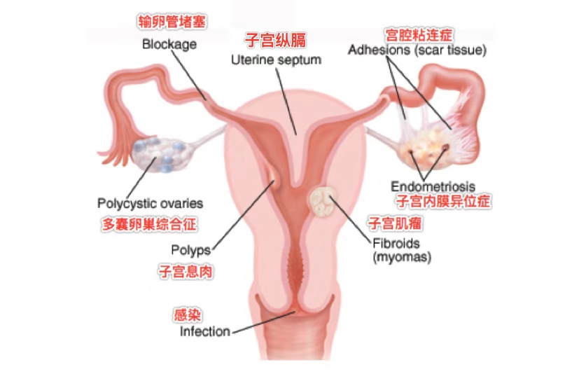 生之源试管助孕公司配图集194